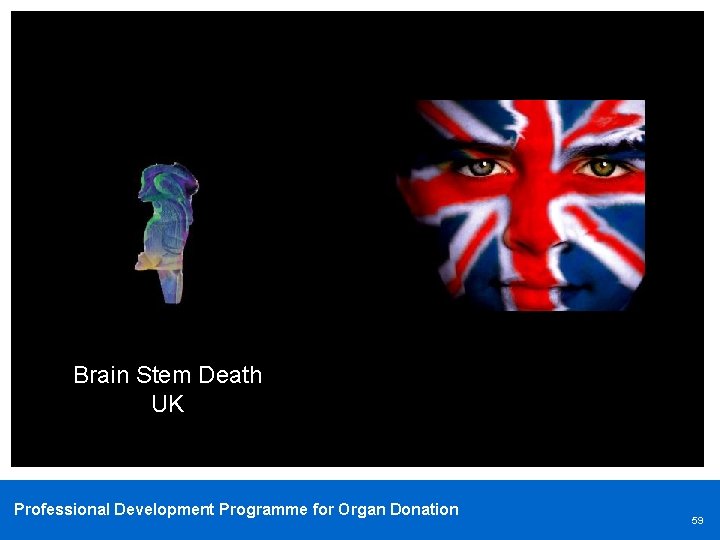 Brain Stem Death UK Professional Development Programme for Organ Donation 59 