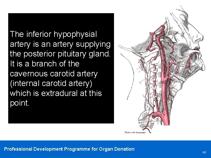 The inferior hypophysial artery is an artery supplying the posterior pituitary gland. It is