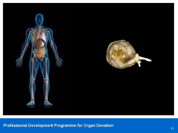 Professional Development Programme for Organ Donation 62 