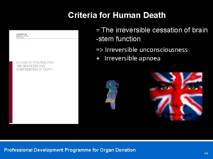 Criteria for Human Death = The irreversible cessation of brain -stem function => Irreversible