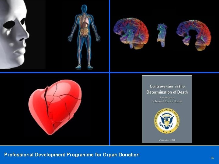 Professional Development Programme for Organ Donation 75 