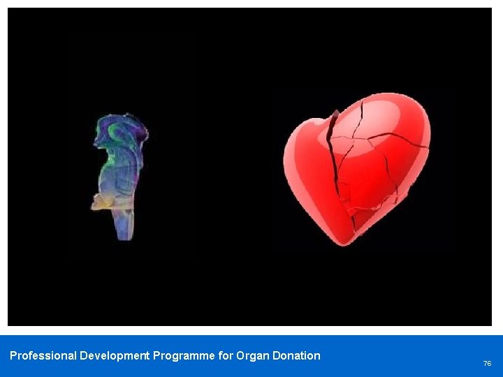 Professional Development Programme for Organ Donation 76 