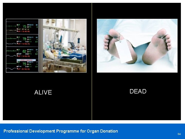 ALIVE Professional Development Programme for Organ Donation DEAD 84 