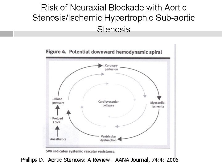 Risk of Neuraxial Blockade with Aortic Stenosis/Ischemic Hypertrophic Sub-aortic Stenosis Phillips D. Aortic Stenosis: