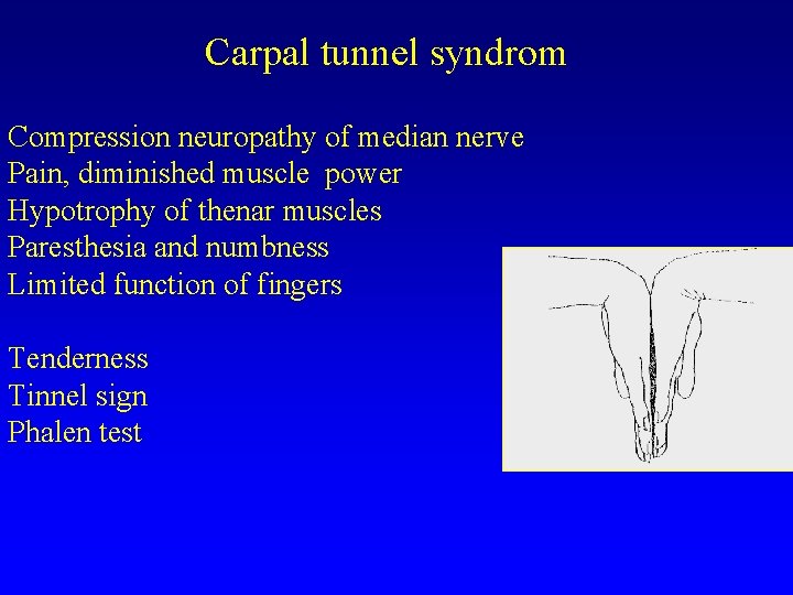 Carpal tunnel syndrom Compression neuropathy of median nerve Pain, diminished muscle power Hypotrophy of