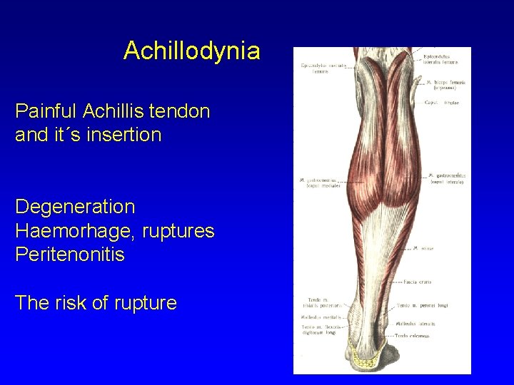 Achillodynia Painful Achillis tendon and it´s insertion Degeneration Haemorhage, ruptures Peritenonitis The risk of
