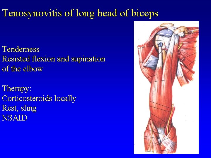 Tenosynovitis of long head of biceps Tenderness Resisted flexion and supination of the elbow