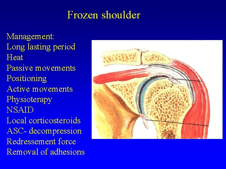 Frozen shoulder Management: Long lasting period Heat Passive movements Positioning Active movements Physioterapy NSAID