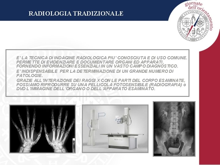 RADIOLOGIA TRADIZIONALE E’ LA TECNICA DI INDAGINE RADIOLOGICA PIU’ CONOSCIUTA E DI USO COMUNE.