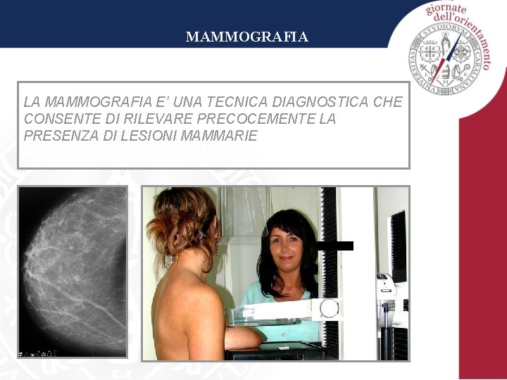 MAMMOGRAFIA LA MAMMOGRAFIA E’ UNA TECNICA DIAGNOSTICA CHE CONSENTE DI RILEVARE PRECOCEMENTE LA PRESENZA