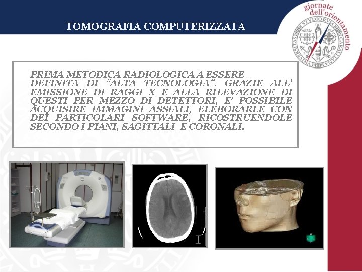 TOMOGRAFIA COMPUTERIZZATA PRIMA METODICA RADIOLOGICA A ESSERE DEFINITA DI “ALTA TECNOLOGIA”. GRAZIE ALL’ EMISSIONE