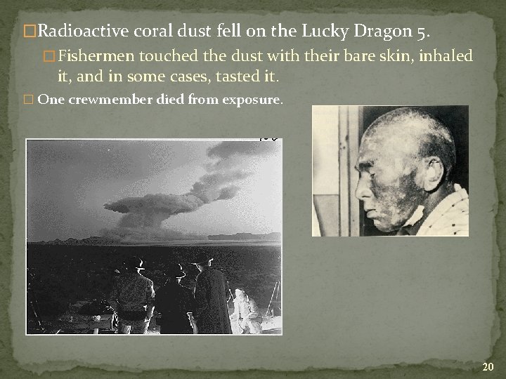 �Radioactive coral dust fell on the Lucky Dragon 5. � Fishermen touched the dust