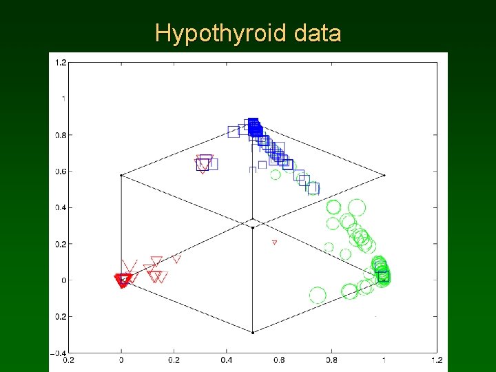 Hypothyroid data 