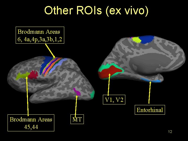 Other ROIs (ex vivo) Brodmann Areas 6, 4 a, 4 p, 3 a, 3