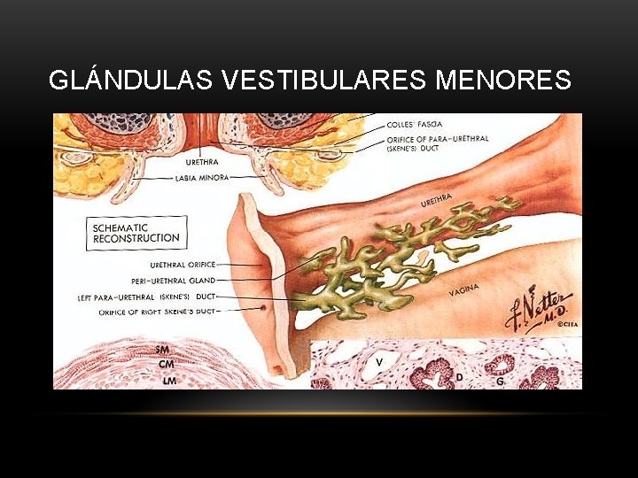 GLÁNDULAS VESTIBULARES MENORES 