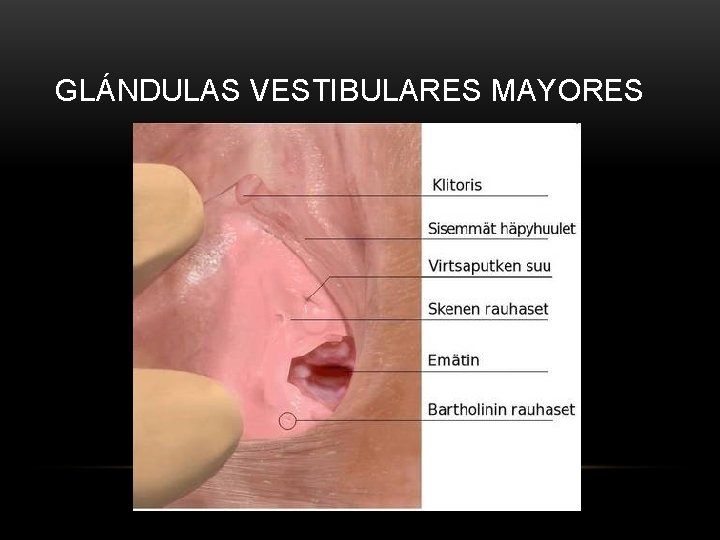 GLÁNDULAS VESTIBULARES MAYORES 