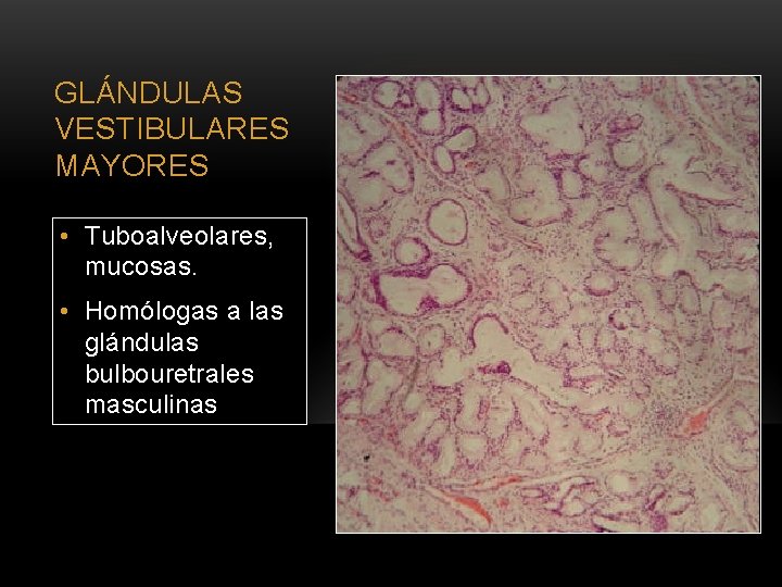 GLÁNDULAS VESTIBULARES MAYORES • Tuboalveolares, mucosas. • Homólogas a las glándulas bulbouretrales masculinas 