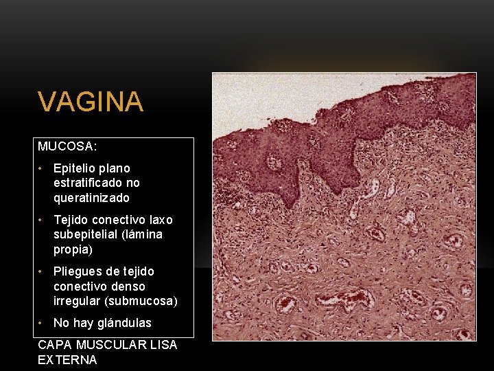 VAGINA MUCOSA: • Epitelio plano estratificado no queratinizado • Tejido conectivo laxo subepitelial (lámina