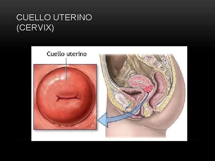CUELLO UTERINO (CERVIX) 