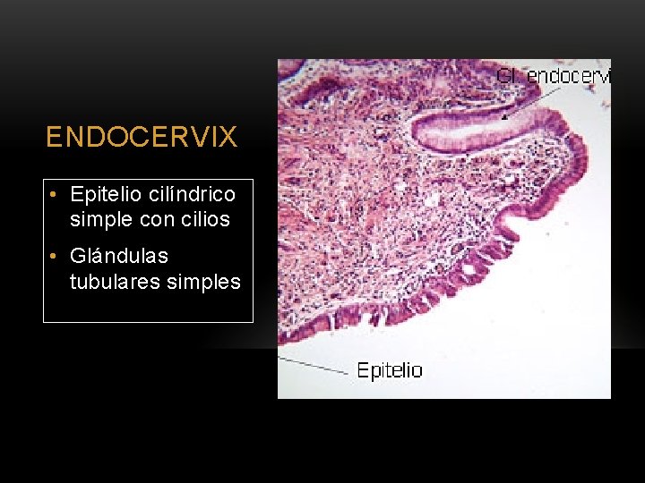 ENDOCERVIX • Epitelio cilíndrico simple con cilios • Glándulas tubulares simples 