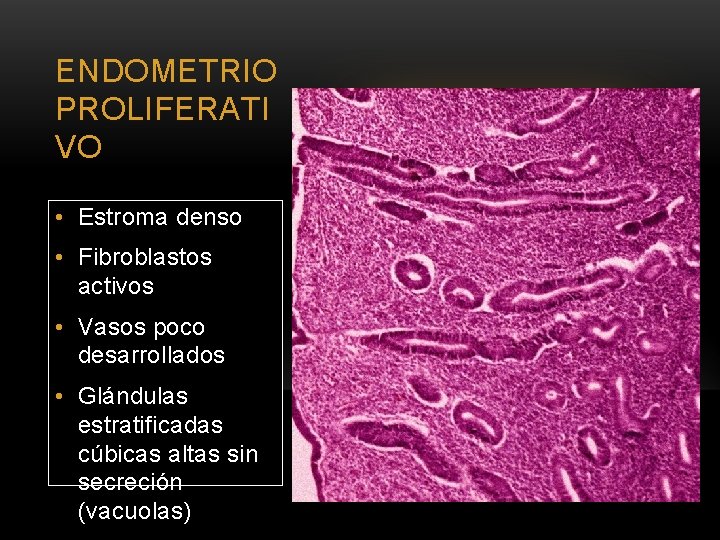 ENDOMETRIO PROLIFERATI VO • Estroma denso • Fibroblastos activos • Vasos poco desarrollados •