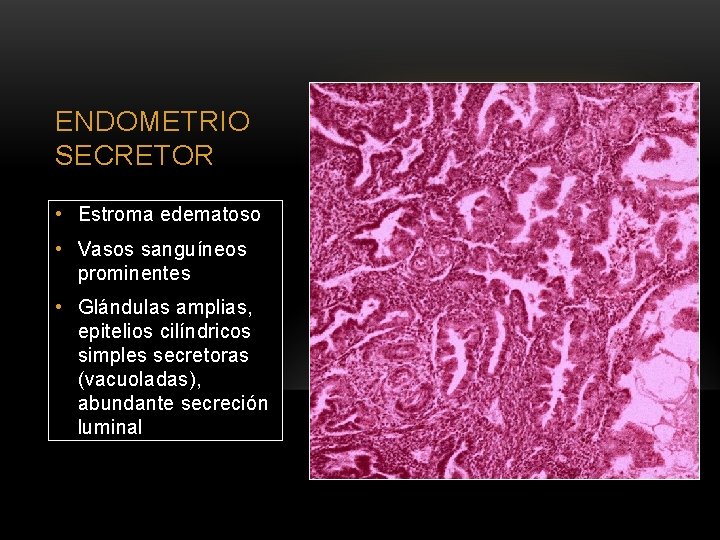 ENDOMETRIO SECRETOR • Estroma edematoso • Vasos sanguíneos prominentes • Glándulas amplias, epitelios cilíndricos