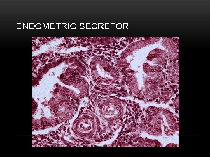 ENDOMETRIO SECRETOR 