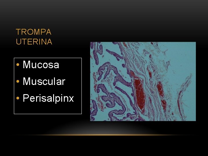 TROMPA UTERINA • Mucosa • Muscular • Perisalpinx 