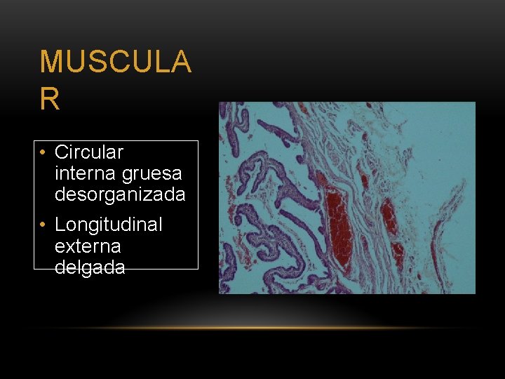 MUSCULA R • Circular interna gruesa desorganizada • Longitudinal externa delgada 