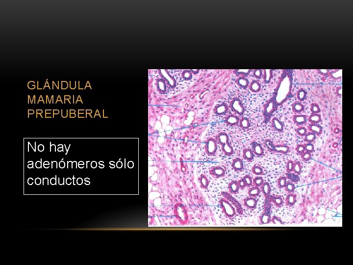GLÁNDULA MAMARIA PREPUBERAL No hay adenómeros sólo conductos 