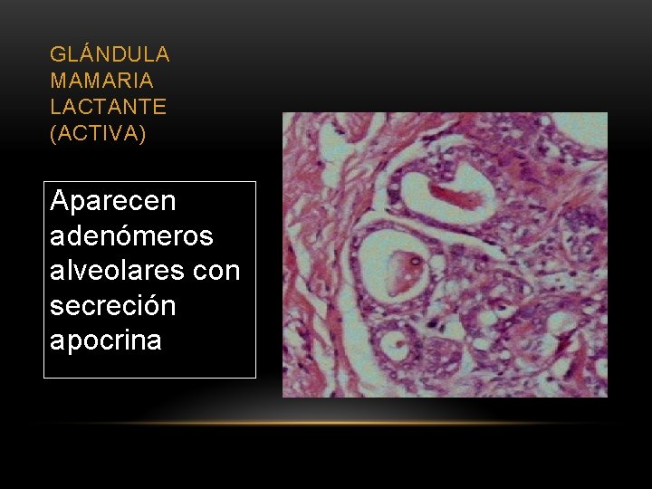 GLÁNDULA MAMARIA LACTANTE (ACTIVA) Aparecen adenómeros alveolares con secreción apocrina 