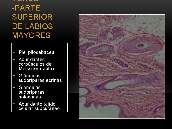 VENUS -PARTE SUPERIOR DE LABIOS MAYORES • Piel pilosebacea • Abundantes corpúsculos de Meissner