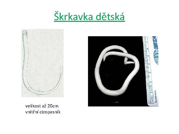 Škrkavka dětská velikost až 20 cm vnitřní cizopasník Škrkavka dětská velikost až 20 cm vnitřní cizopasník