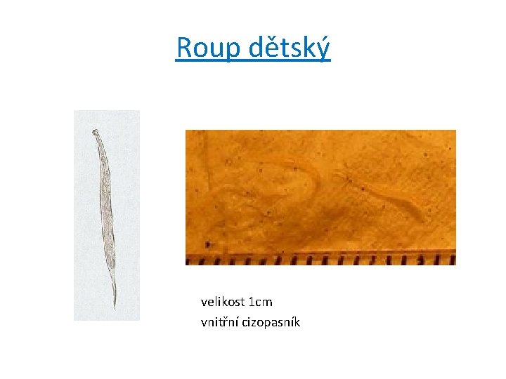 Roup dětský velikost 1 cm vnitřní cizopasník Roup dětský velikost 1 cm vnitřní cizopasník