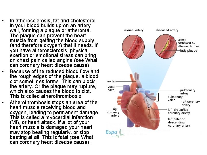  • • • In atherosclerosis, fat and cholesterol in your blood builds up