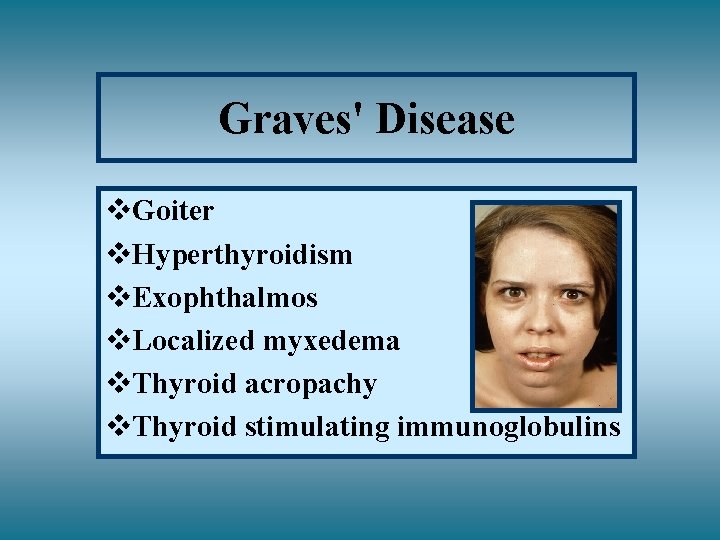 Graves' Disease v. Goiter v. Hyperthyroidism v. Exophthalmos v. Localized myxedema v. Thyroid acropachy