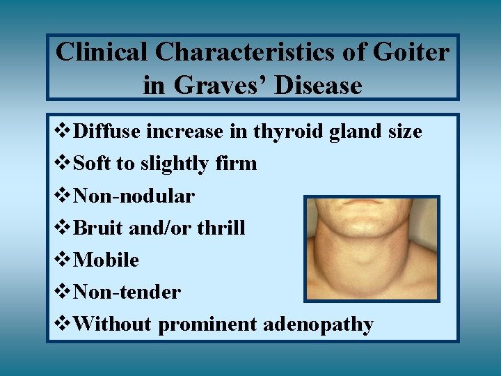 Clinical Characteristics of Goiter in Graves’ Disease v. Diffuse increase in thyroid gland size