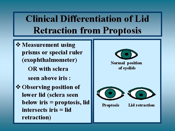 Clinical Differentiation of Lid Retraction from Proptosis v Measurement using prisms or special ruler