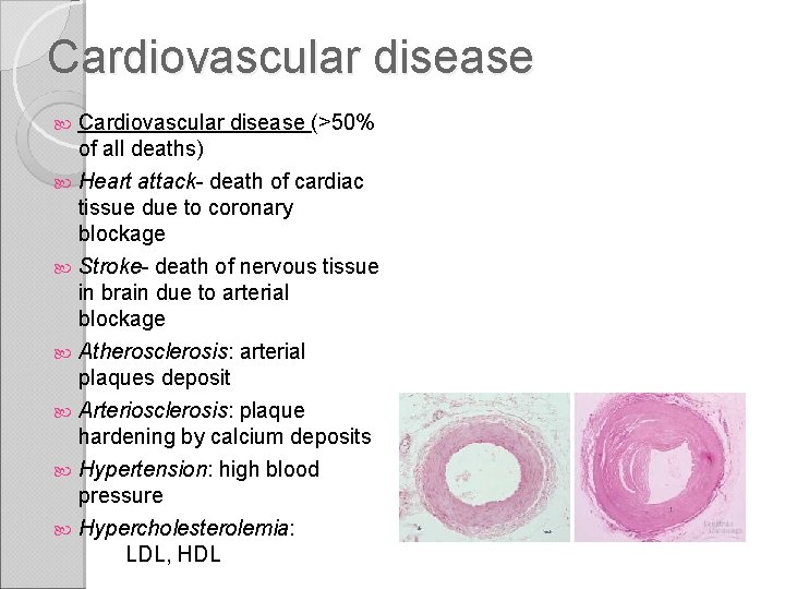 Cardiovascular disease (>50% of all deaths) Heart attack- death of cardiac tissue due to
