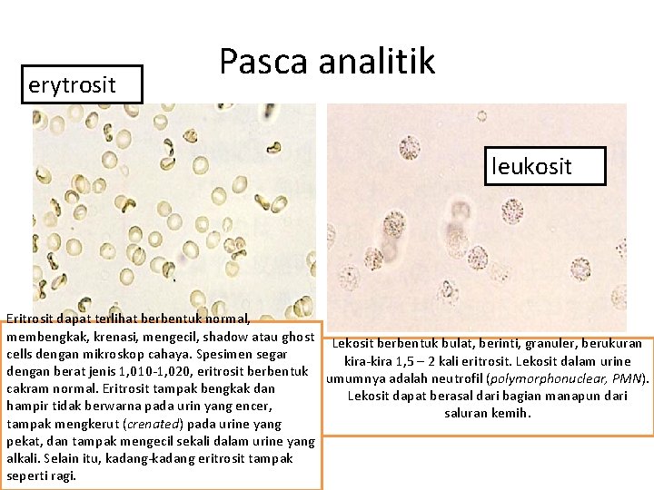 erytrosit Pasca analitik leukosit Eritrosit dapat terlihat berbentuk normal, membengkak, krenasi, mengecil, shadow atau