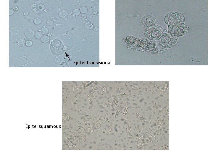 Epitel transisional Epitel squamous 