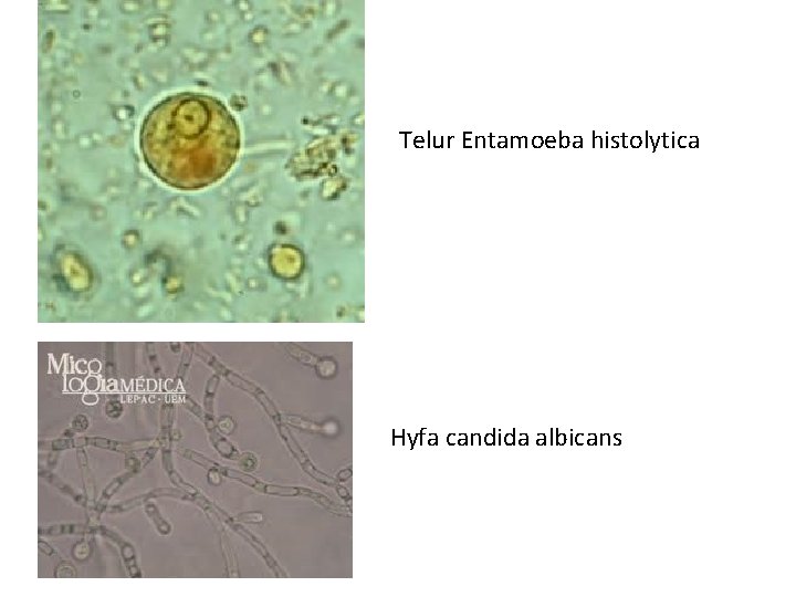 Telur Entamoeba histolytica Hyfa candida albicans 