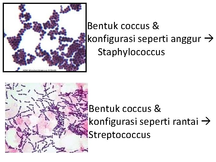 Bentuk coccus & konfigurasi seperti anggur Staphylococcus Bentuk coccus & konfigurasi seperti rantai Streptococcus