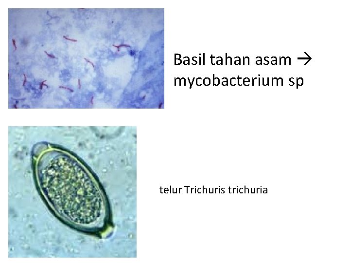 Basil tahan asam mycobacterium sp telur Trichuris trichuria 