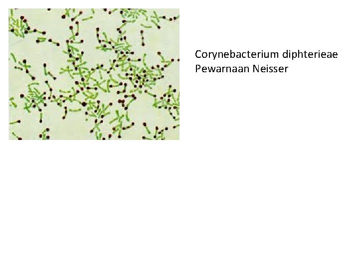 Corynebacterium diphterieae Pewarnaan Neisser 