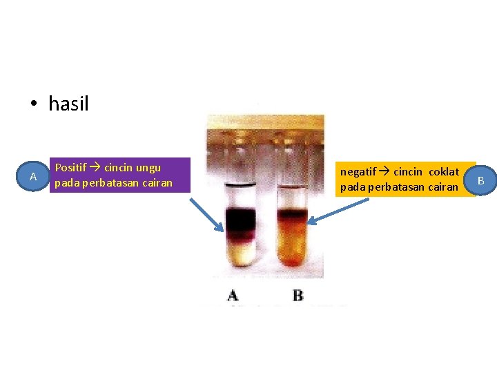  • hasil A Positif cincin ungu pada perbatasan cairan negatif cincin coklat pada