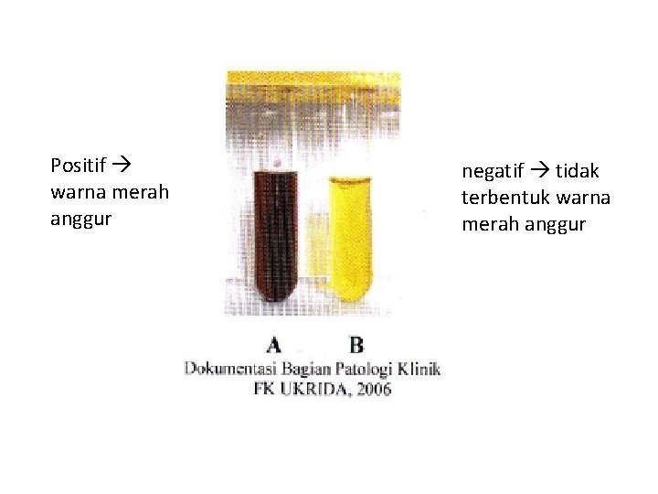 Positif warna merah anggur negatif tidak terbentuk warna merah anggur 