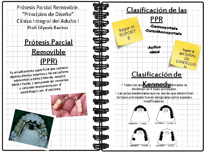 Prótesis Parcial Removible. “Principios de Diseño” Clínica Integral del Adulto I Prof: Glyexis Barrios
