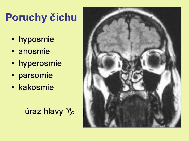 Poruchy čichu • • • hyposmie anosmie hyperosmie parsomie kakosmie úraz hlavy Poruchy čichu • • • hyposmie anosmie hyperosmie parsomie kakosmie úraz hlavy