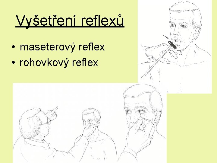 Vyšetření reflexů • maseterový reflex • rohovkový reflex Vyšetření reflexů • maseterový reflex • rohovkový reflex